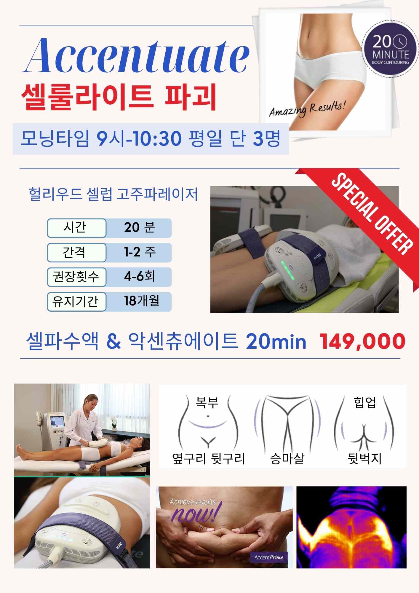 셀룰라이트