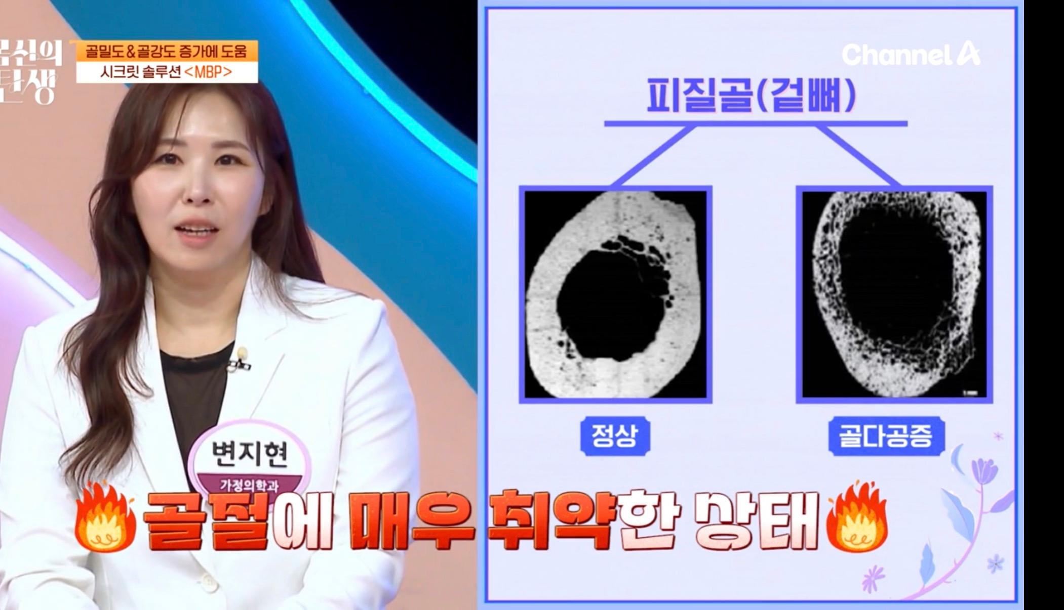 SHG Clinic 방송 미디어 자료 09